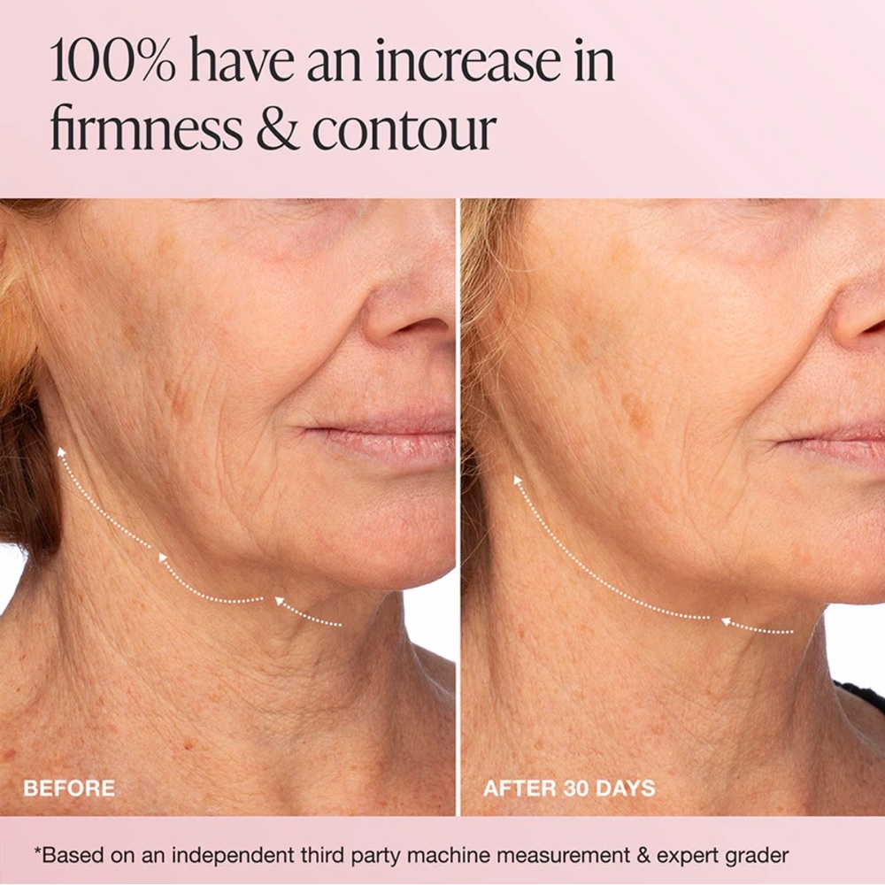 INNBeauty Extreme Cream Firming & Lifting - Picture 2 of 11
